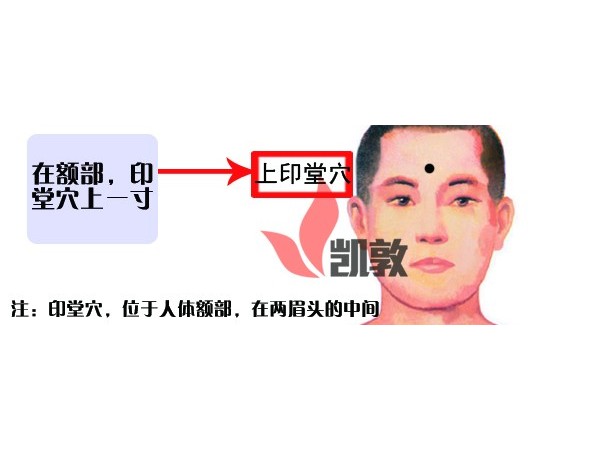 【凱敦穴位知識】上印堂穴