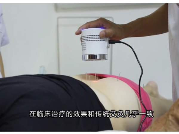 熱敏灸治療女性宮寒見(jiàn)效快
