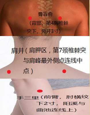 肩周炎