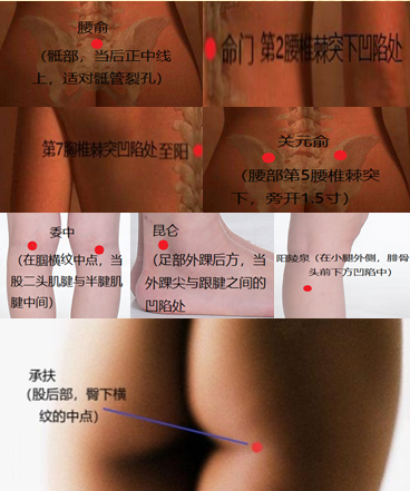 腰椎間盤突出