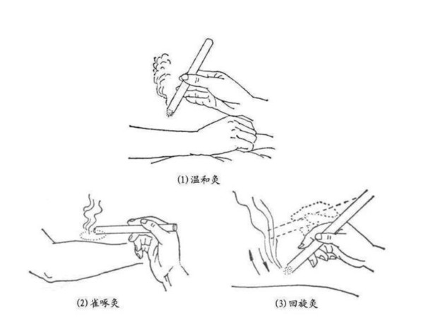 懸灸是什么東西？和艾灸有什么區(qū)別嗎？
